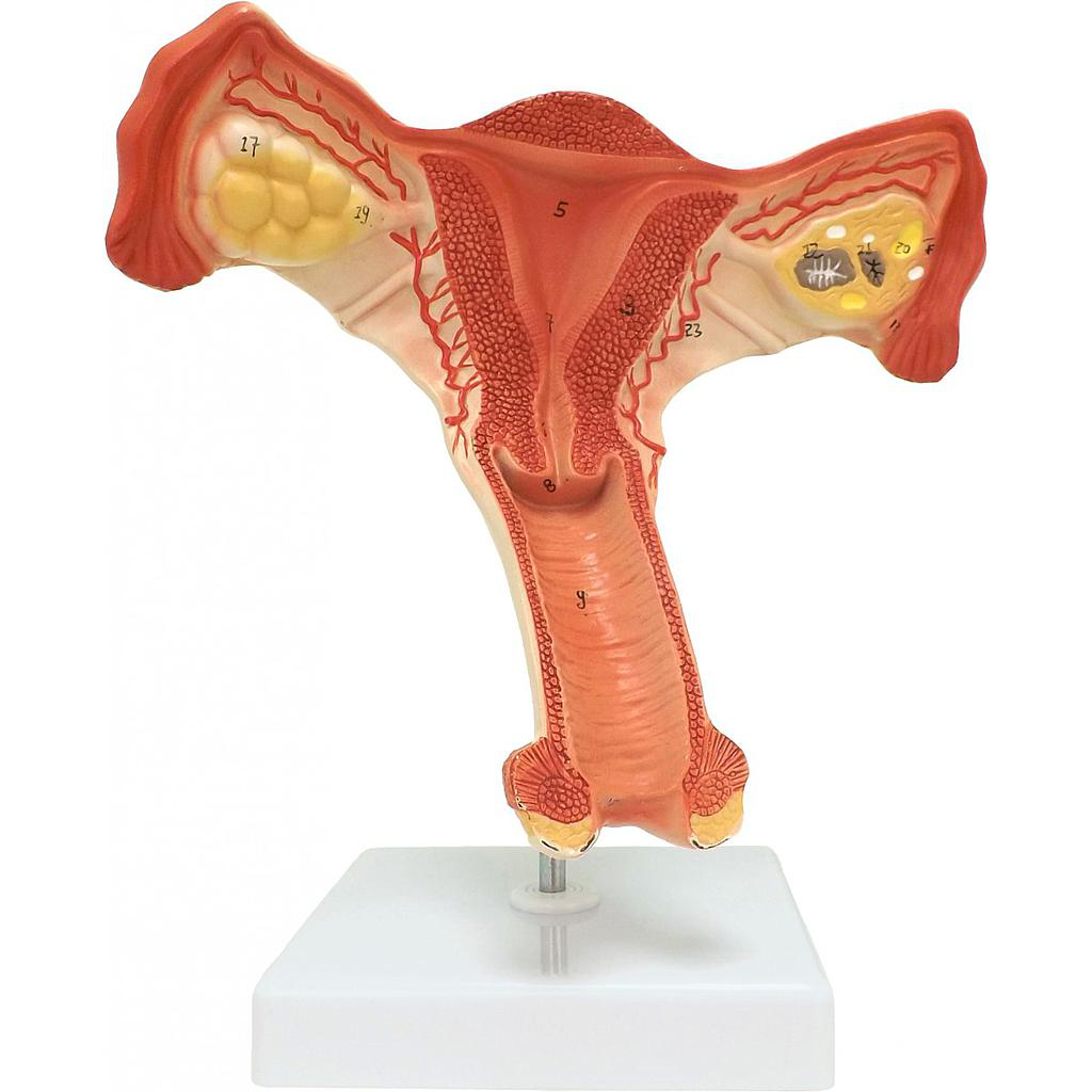 Maqueta de Órgano Reproductivo femenino, Útero Sección Transversal Juvale A583