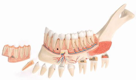 Mitad de la Mandíbula Inferior con 8 Dientes Cariados, 19 piezas - 3B Smart Anatomy/ 3B Scientific 1001250 [VE290]