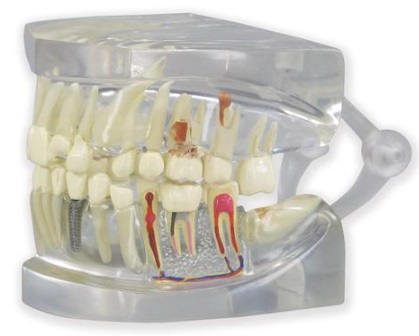 Modelo de Mandíbula Humana Transparente con Dientes/ 3B Scientific 1019540