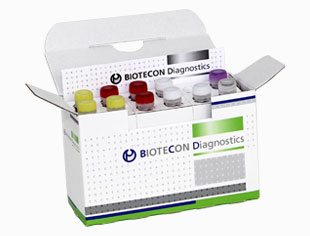 Kit de Detección E coli O 157/ Biotecon/R-300-10