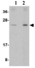 Anticuerpo anti-REDD-1 / DDIT4 Abcam ab106356