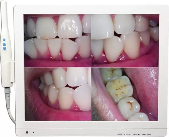 Cámara intraoral