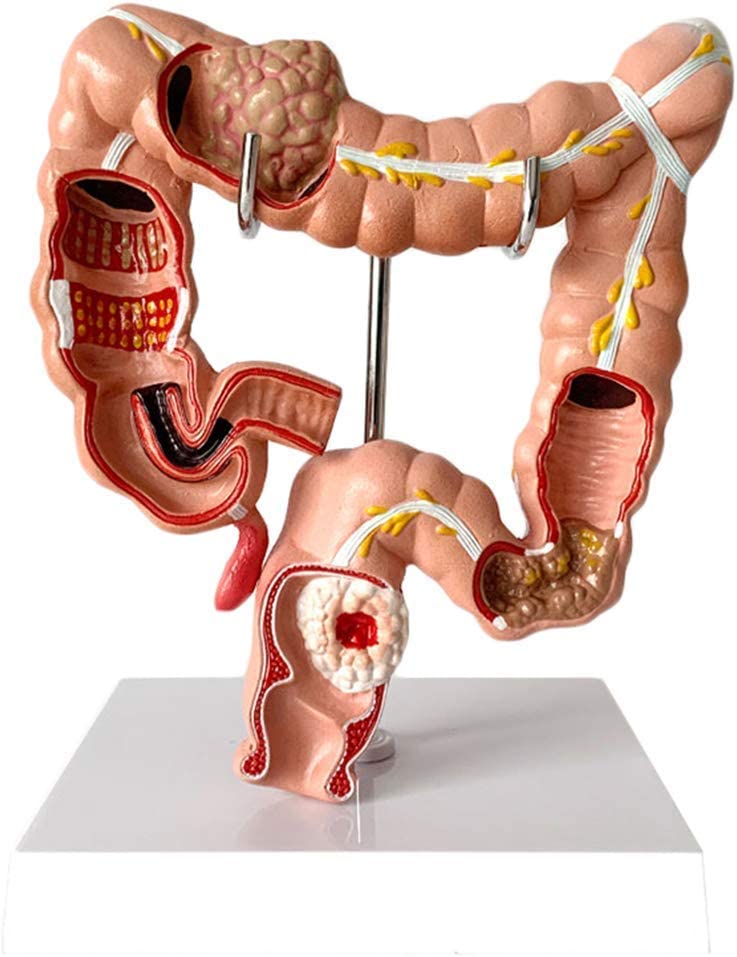 Maqueta de Pene para uso de Condón, Piel Clara 3B Scientific 1000340 [L42] ​