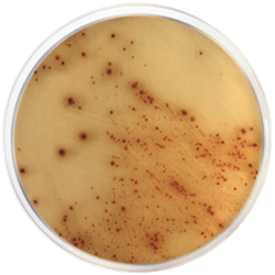 Base de agar cromogénico E. coli O157:H7 Condalab 1588