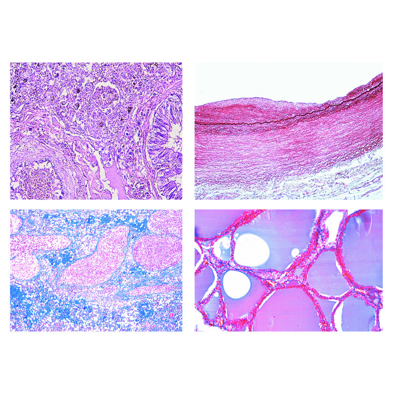 Patología humana, serie corta, 50 preparaciones para microscopio LIEDER 54212