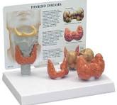 Modelo de tiroides