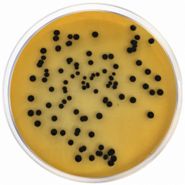 Agar Salmonella Shigella (Agar SS) Condalab 1064