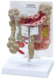 Maqueta de Colon Marca GPI Anatomical 3340
