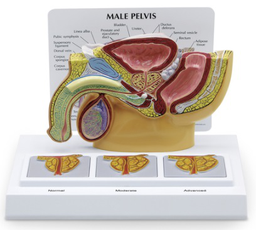 Maqueta de Pelvis Masculina con Imágenes de Próstata en 3D 1019563