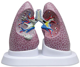 Maqueta de Pulmón con Patologías Marca 3bscientific Modelo 3110