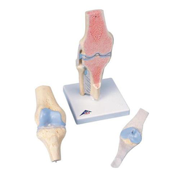 Maqueta de la articulación de la rodilla, dividido en 3 partes 3B Scientific 1000180 [A89]