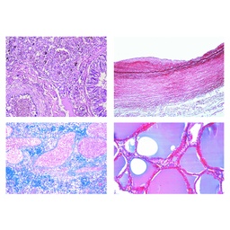 Patología humana, serie corta, 50 preparaciones para microscopio